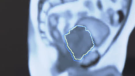 highlighted tongue in medical image