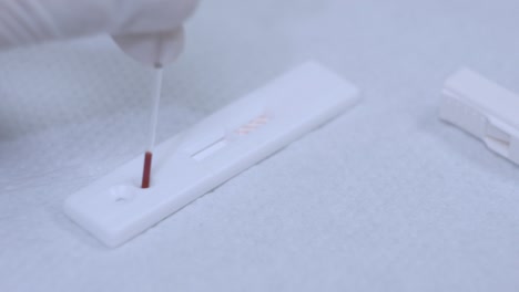 HIV-Testgeräte-Auf-Dem-Tisch.-Blutanalysegerät-Testen.-Bluttest-HIV