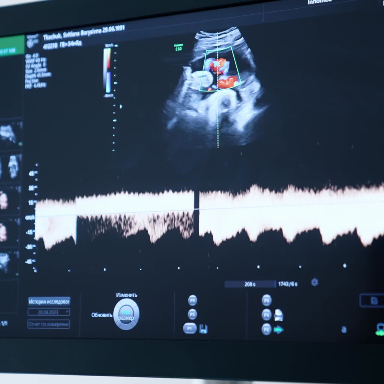 Black screen of ultrasonic equipment. Monitor showing fetal heartbeat. Close up