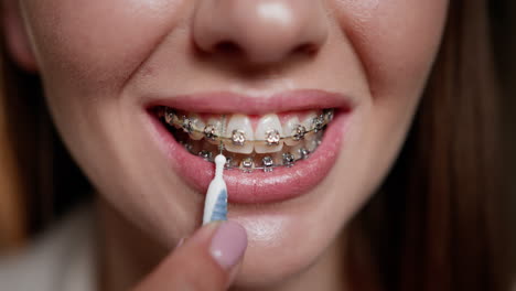 mujer limpiando los dientes con aparatos ortopédicos usando un cepillo interdental