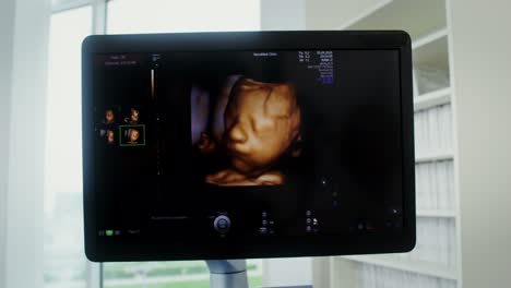 3d ultrasound scan of a fetus