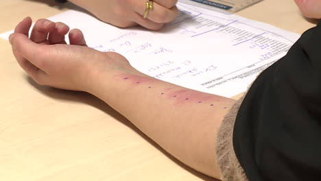 allergy skin test