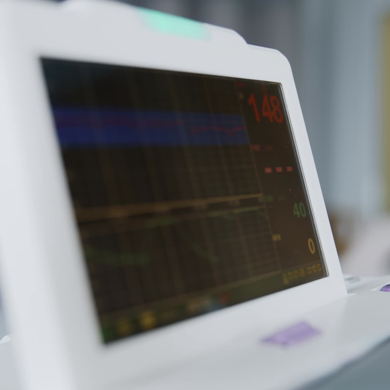 Little screen of a electrocardiographic equipment. Check up of fetal heartbeat of a pregnant woman. Close up