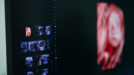 fetal ultrasound scan