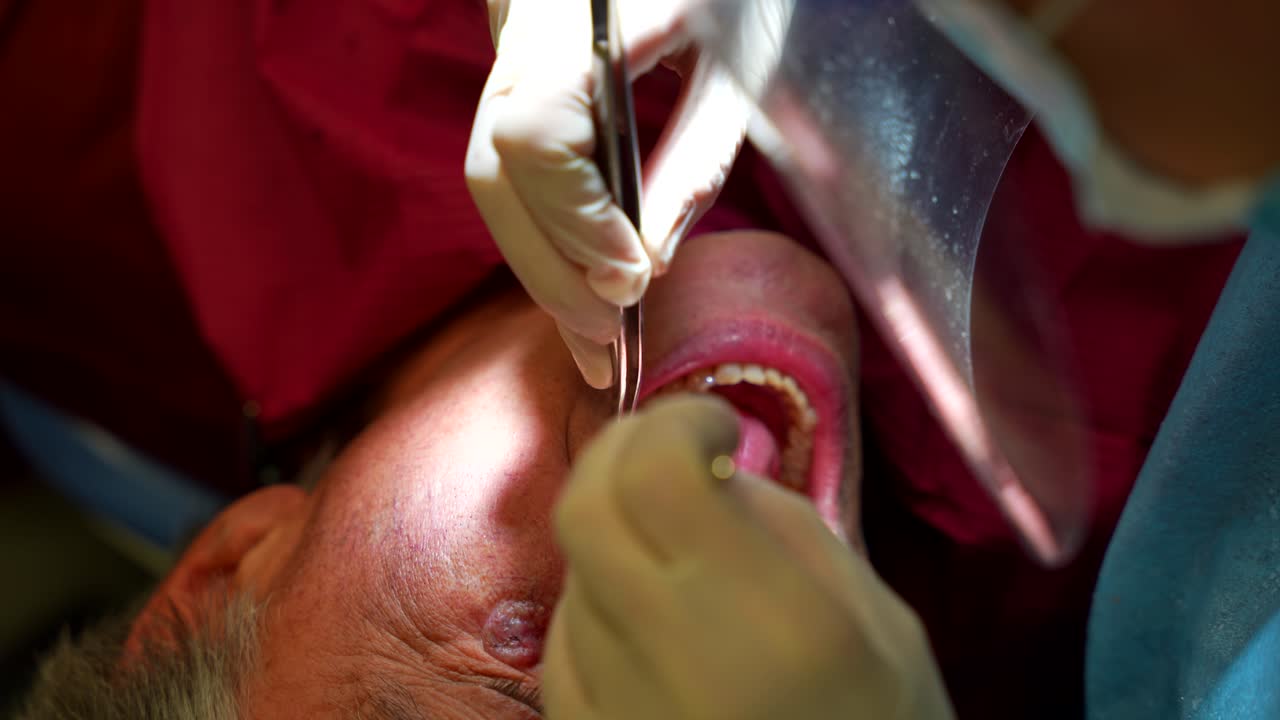 Top-down shot of a dentist removing a patient's denture insulator using a mouth mirror in a dental clinic