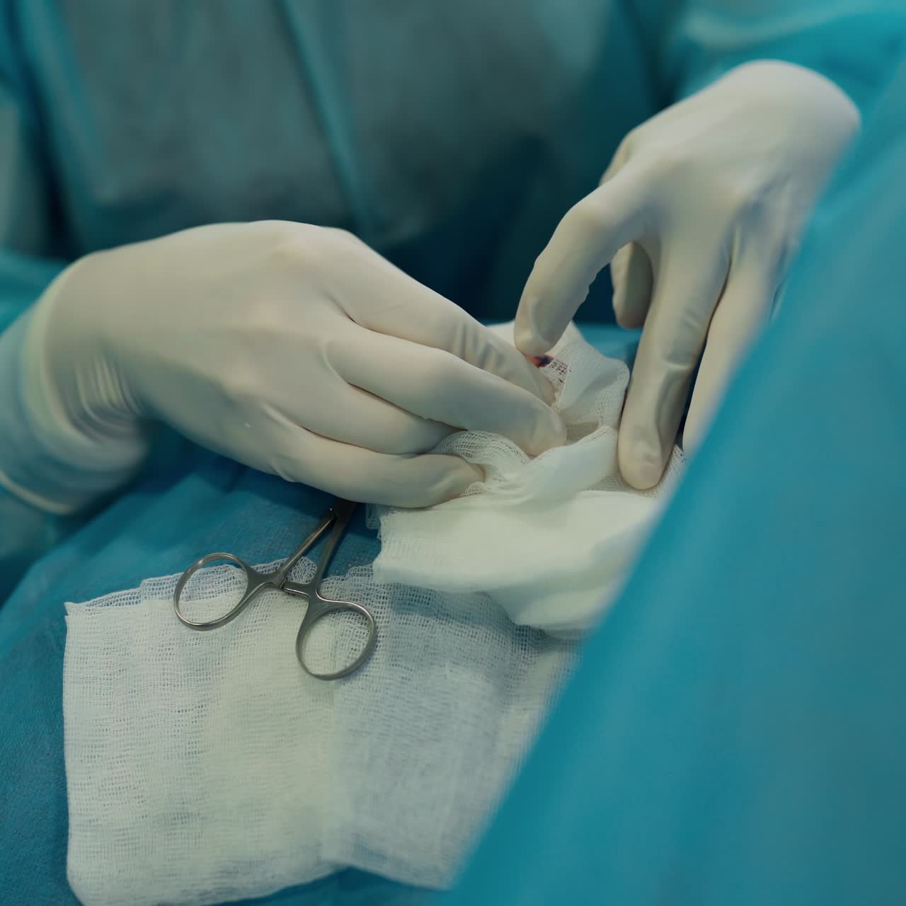 Cosmetic plastic surgery