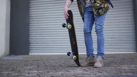 Albino-african-american-man-holding-skateboard