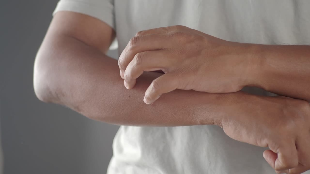 Person scratching their arm due to itch or skin irritation