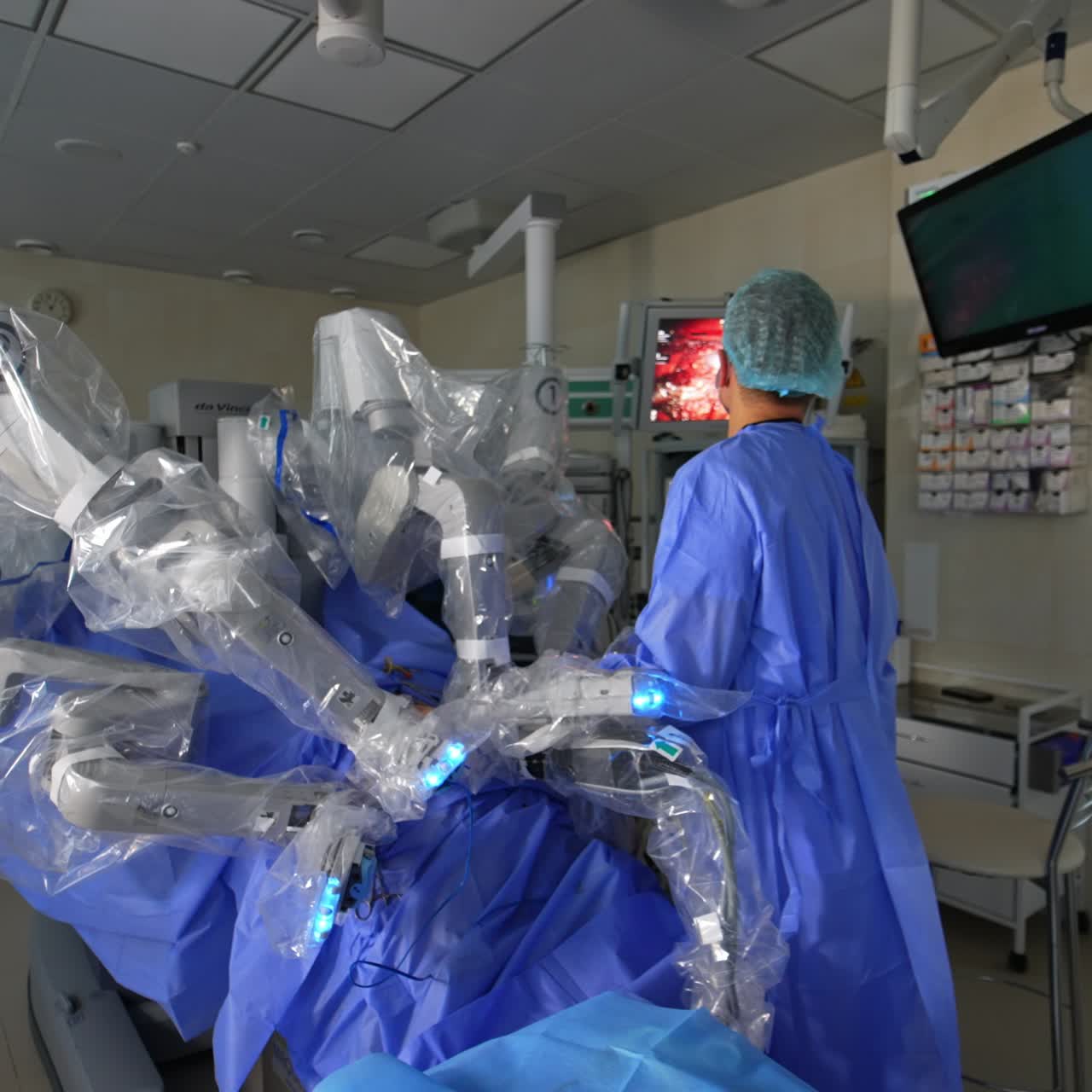 Four massive robotic arms are over the patient on operational table. Doctor standing in operative field watches the work of robotic forceps on the monitor