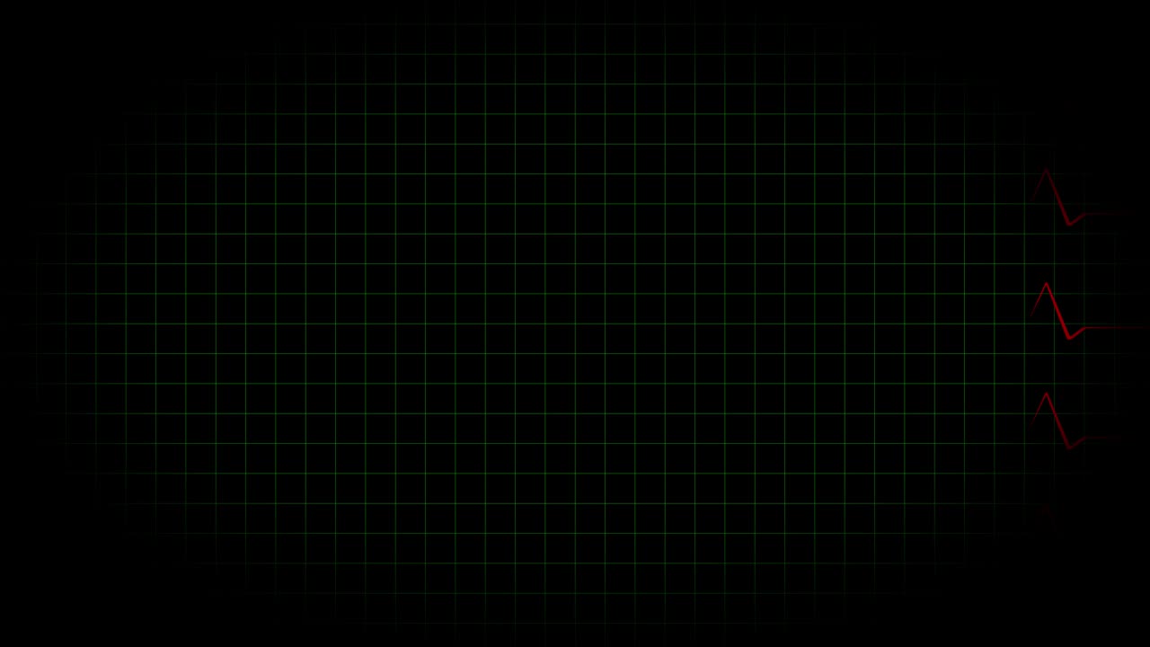 전기 심장 기록 오실로스코프 파동 형태 애니메이션 모션 그래픽