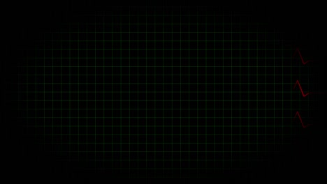 electrocardiograma osciloscopio forma de onda animación gráficos de movimiento