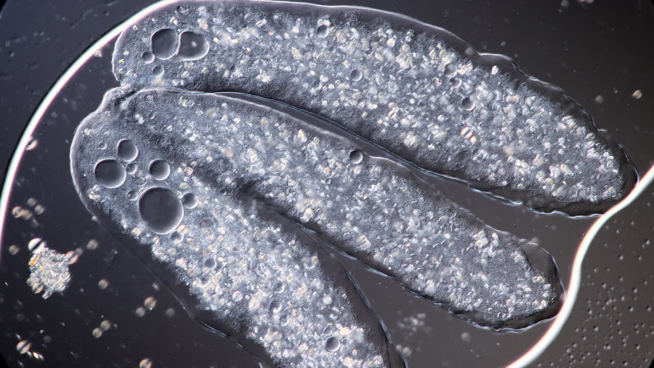 Microscopic View of Amoeba-like Organisms or Protists