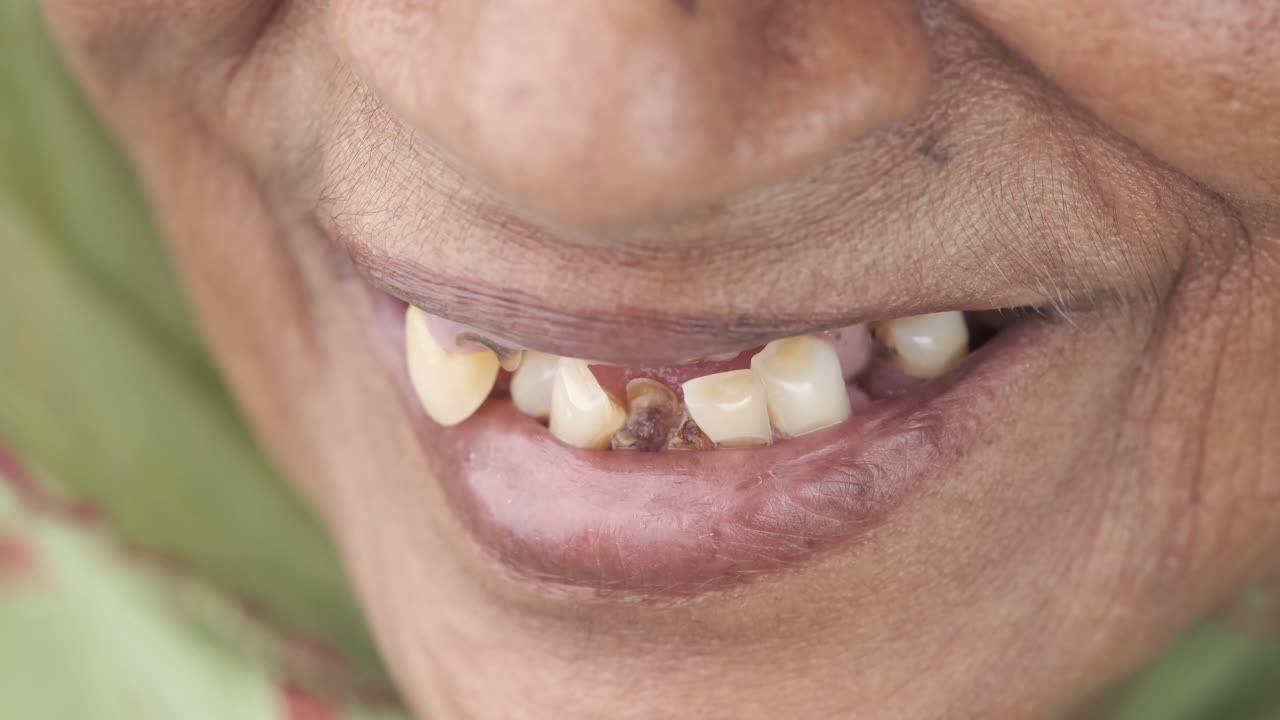 problemas dentales en adultos mayores