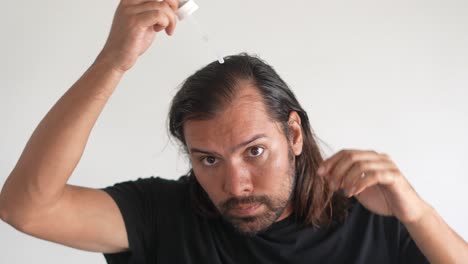 Mann,-Der-Minoxidil-Mit-Einer-Pipette-Ins-Haar-Einträgt,-Glatzenbildung,-Haarwuchsserum