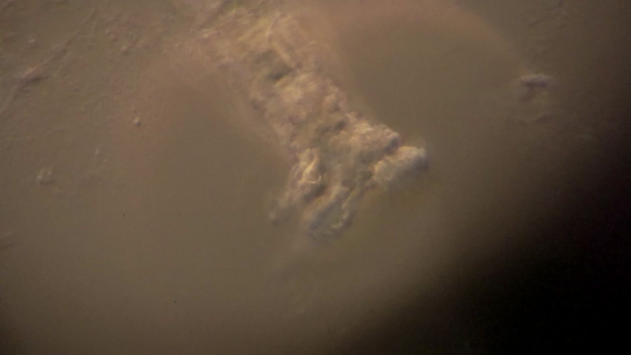 미세한 로티퍼가 먹이를 먹고 이동합니다.