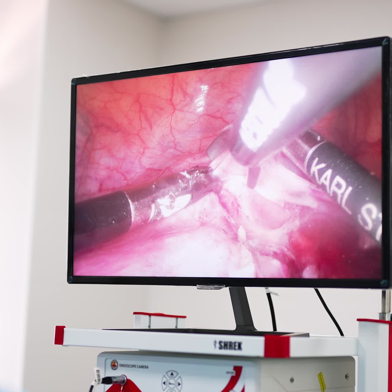 Working big screen in the surgery room. Inner organs operated by high-precise modern instruments