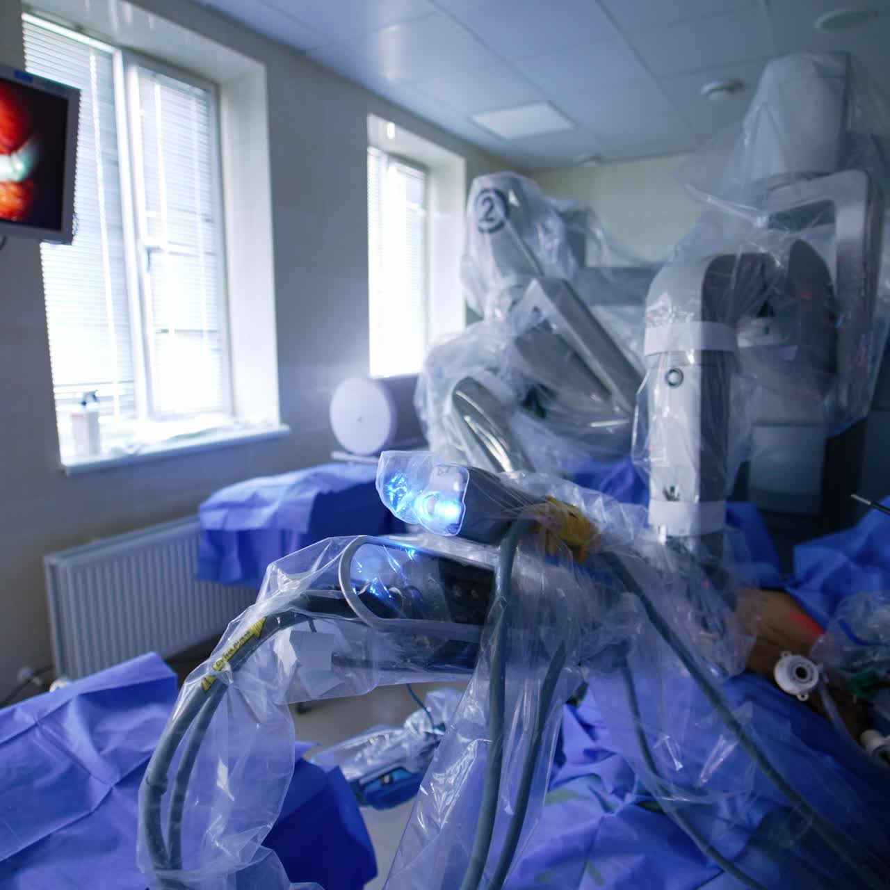 Da Vinci robot arms move at laparoscopic operation. Human doctor cooperates with robotic surgeon in modern operational room