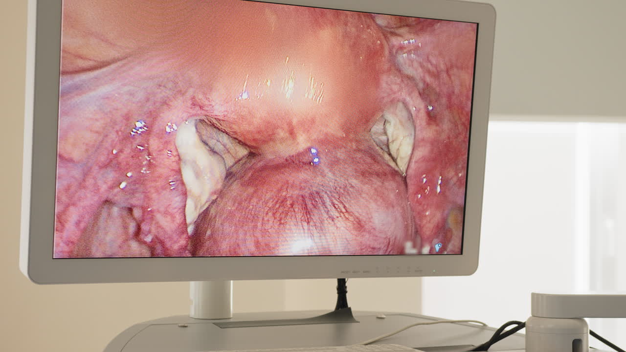 procedimiento de endoscopia