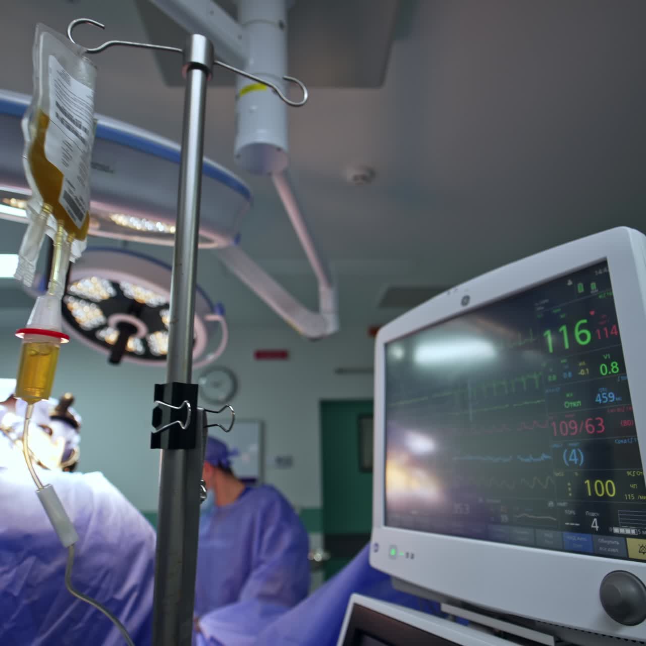 Monitor di lavoro di un respiratore polmonare. Segnali vitali di un paziente sullo schermo nero. Primo piano. Il team medico è impegnato al tavolo operatorio.