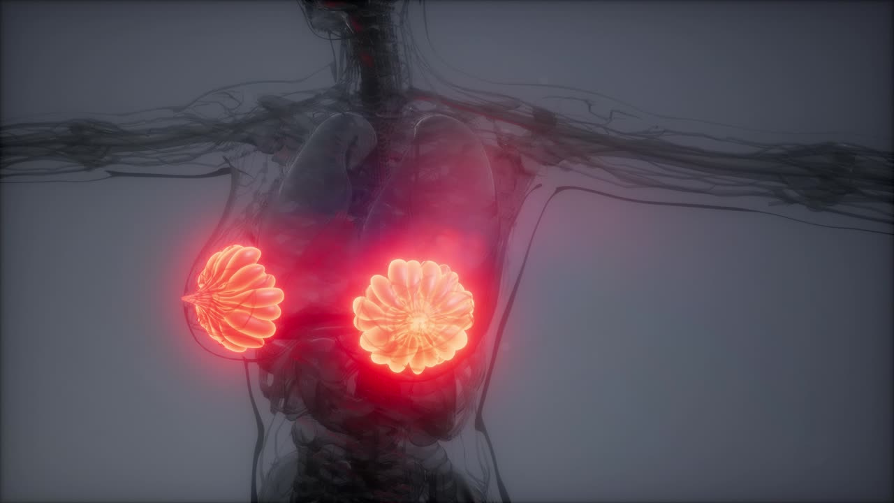 비만 여성의 유방선에 대한 의학적으로 정확한 그림