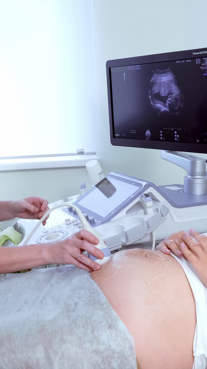 Expectant mother receiving ultrasound examination in a medical clinic with advanced equipment