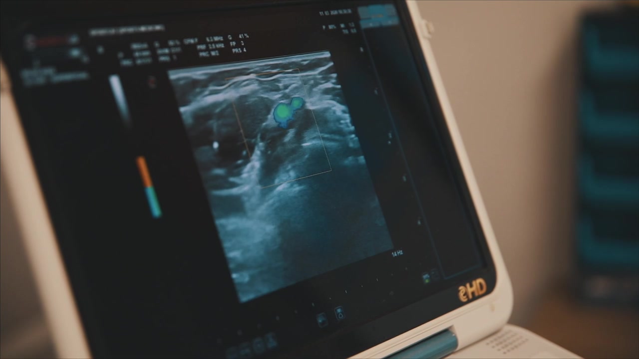 Elleboog- en pols echografie. Close-up. Medische apparatuur.