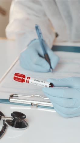 conducting a hepatitis c blood test in a clinical setting with careful attention