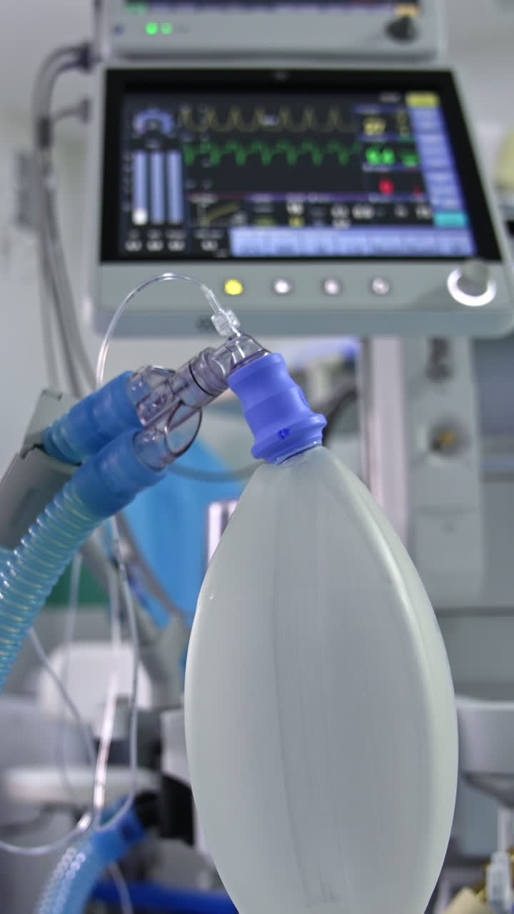 Inflating ambu bag hanging in the surgery room. Screen with life signs from a lung ventilator machine at backdrop in blur. Vertical video