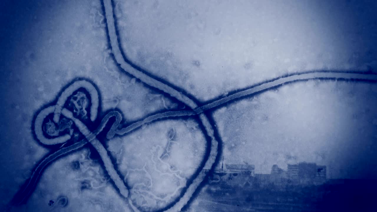 detección de ébola en los aeropuertos. placa de introducción de fondo de 4k.