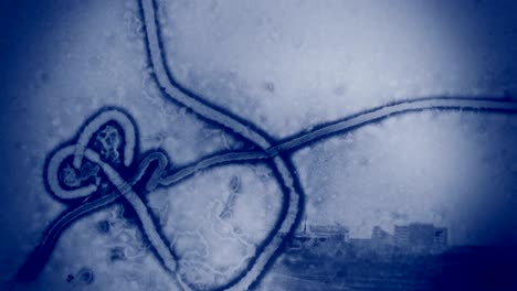 ebola screening in airports. 4k background intro plate.