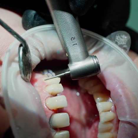 young woman at dentist