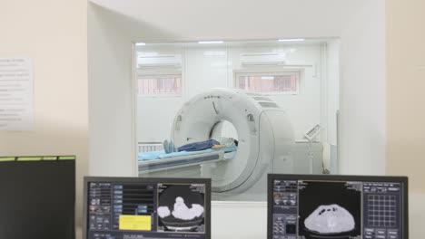 two qualified radiologists examines female patient who is lying under ct or mri scanner. computer screen with result diagnosis image. view through glass window in a modern clinic.