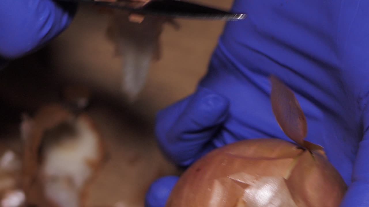 pelar la cabeza de la cebolla con las manos y un cuchillo