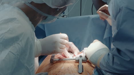 doctor uses micro forceps during surgery. cardiothoracic surgeon with surgical team ends procedure in opened chest cavity preparing skin cut for sewing