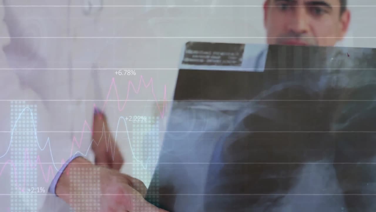 animación del procesamiento de datos estadísticos sobre dos médicos varones diferentes que examinan rayos x en el hospital