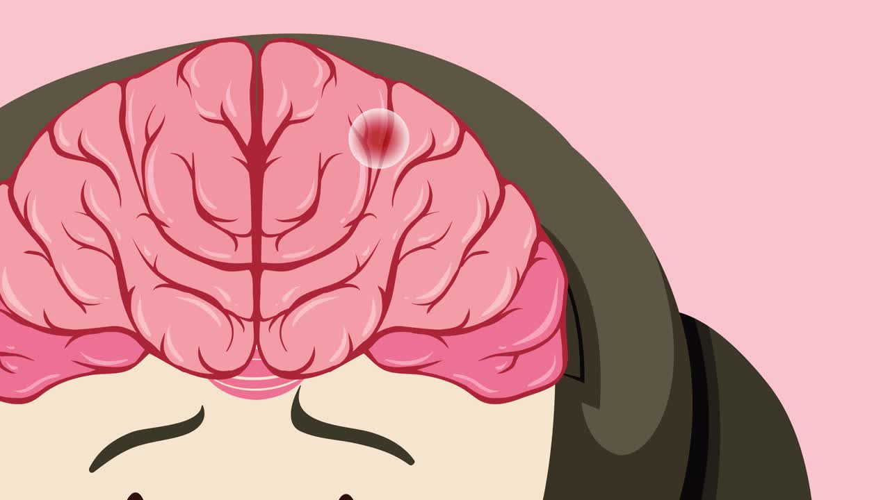 다양한 종류의 스트로크에 대한 애니메이션 설명