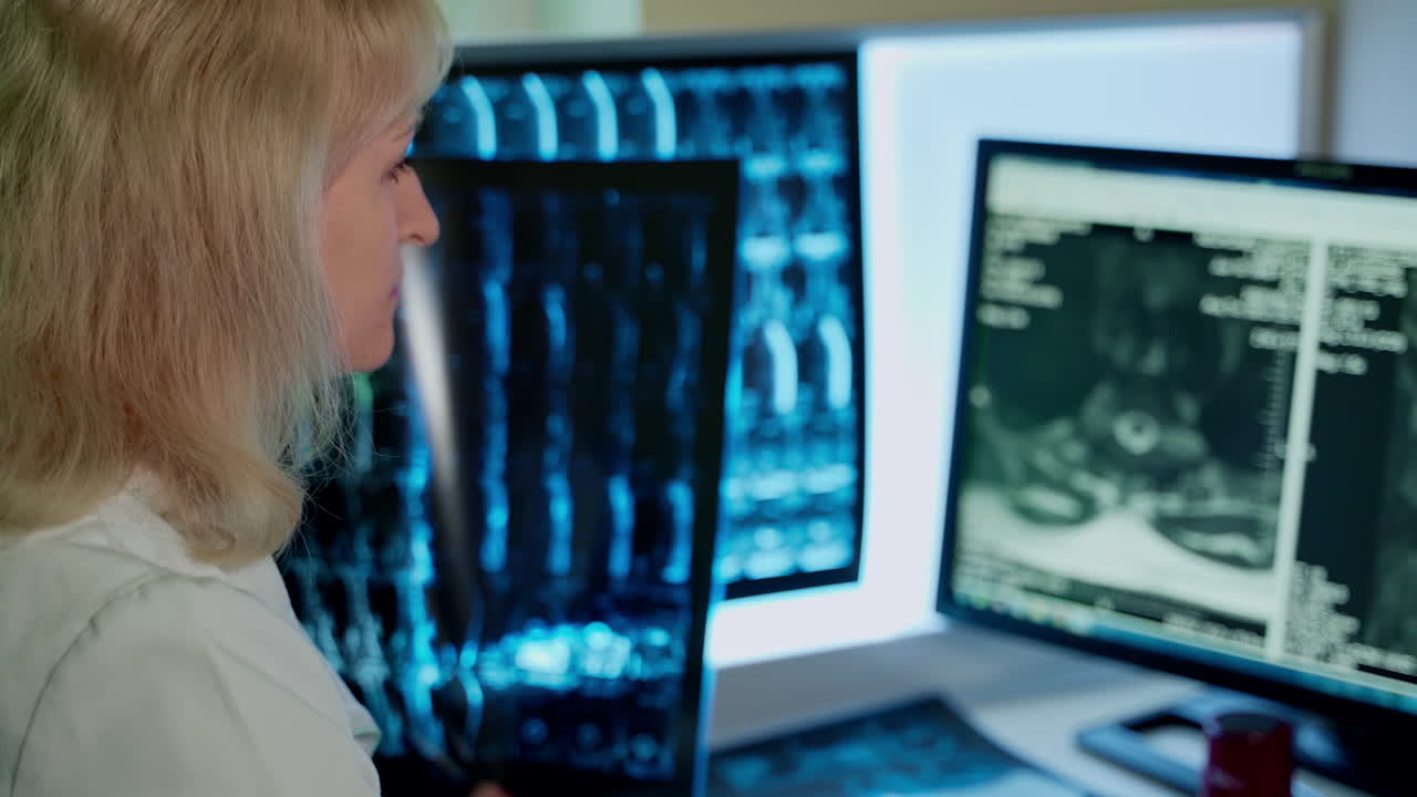Surgeon examining x ray film. Woman doctor looking at x-ray radiography