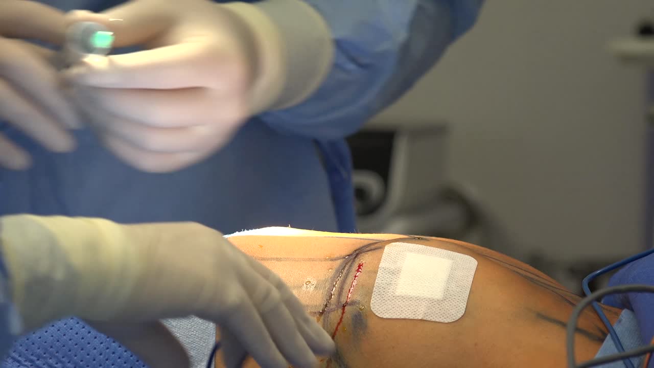 유방 확대술은 여성의 가슴 크기를 늘리고 질감을 변경하는 데 사용되는 유방 이식 및 지방 이식 유방 성형술에 대한 성형 수술 용어입니다.