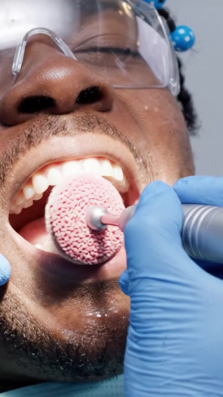 Dental Procedure: Close-Up of Teeth Cleaning Process with Tools in Action, Showcasing Oral Hygiene and Patient Care in a Professional Environment