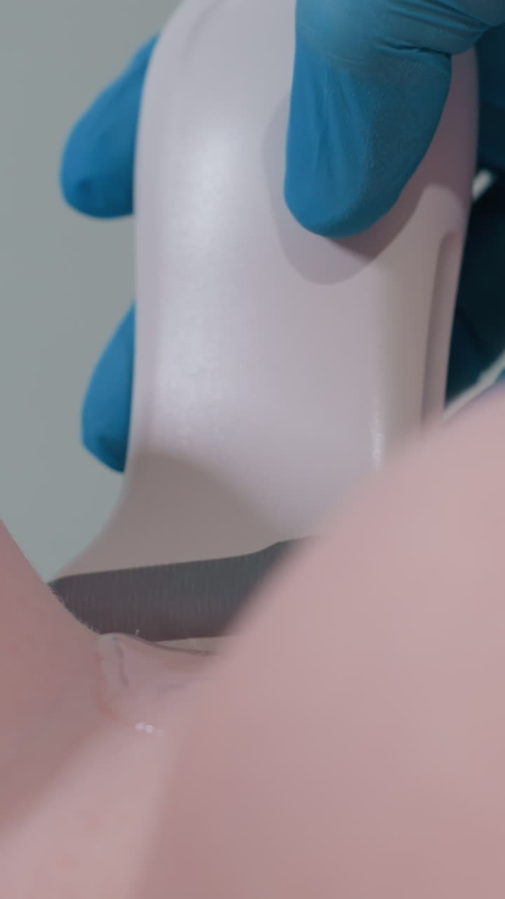 Un radiólogo, en posición supina, utiliza una sonda de ultrasonido sobre el tejido para realizar un examen suave con gel y una mano enguantada, busca quistes y nódulos, captura imágenes en escala de grises, mide los hallazgos y documenta el informe.