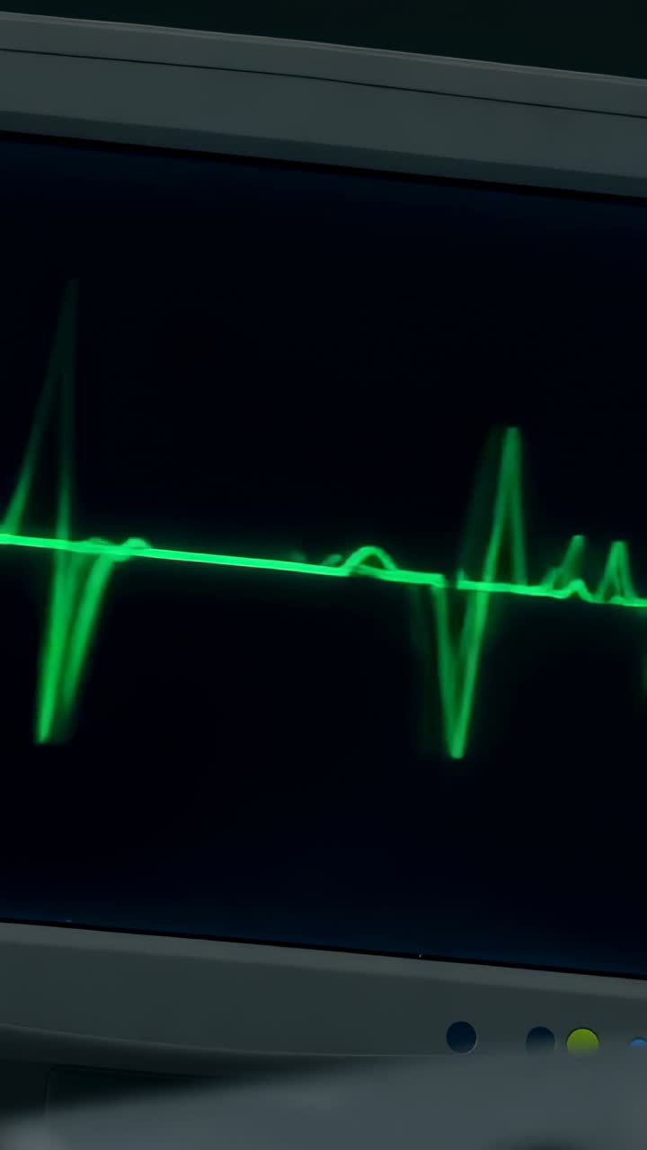 Video verticale: ECG verde mostrato sul monitor di reparto che si sposta dopo il picco QRS a segnale piatto che indica l'arresto