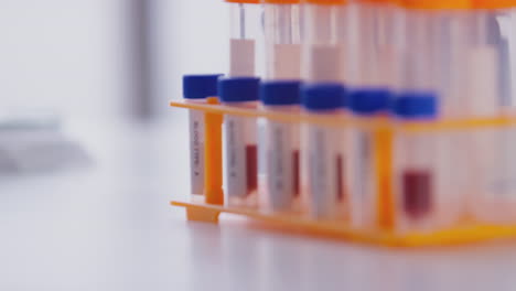 cierre de tubos de ensayo que contienen muestras de grupos sanguíneos en un estante de laboratorio