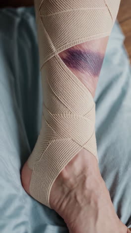 injured ankle with elastic support