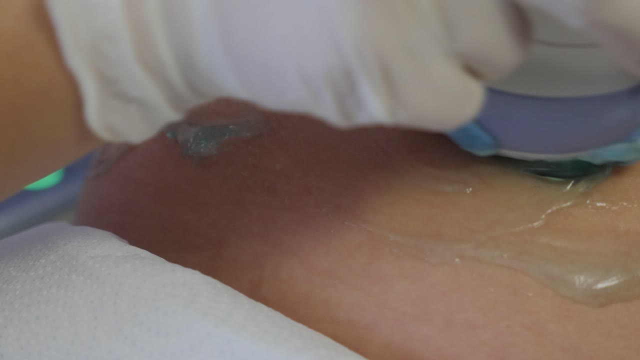 ultrasonido transductor para embarazadas gel azul embarazo barriga escáner ultrasónico primer plano gel conductor ultrasonido 5d