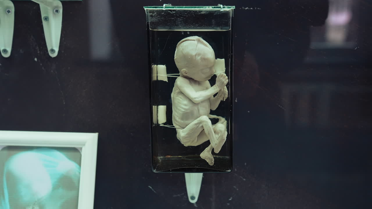 Human model at medical museum. View of anatomical model in museum of medicine