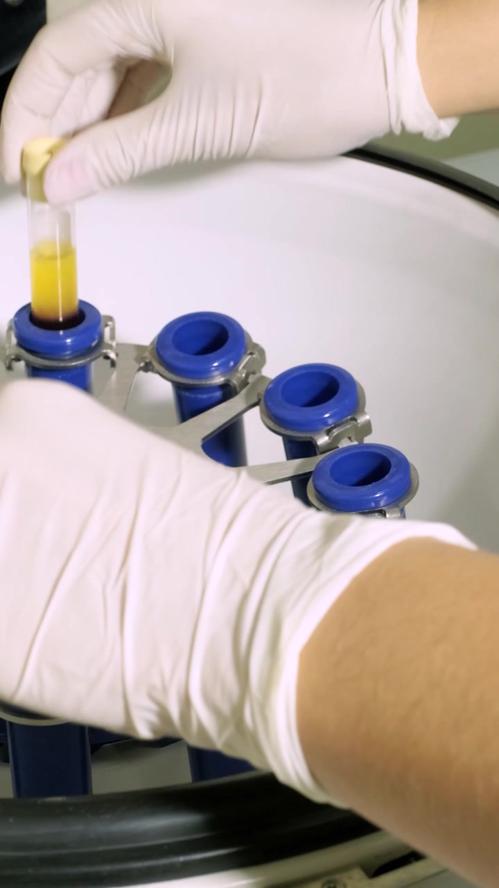 Mano guantata che rimuove campioni di sangue separati dalla centrifuga