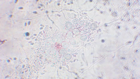freshly hatched germinated slime mold spores to amoeba between other spores