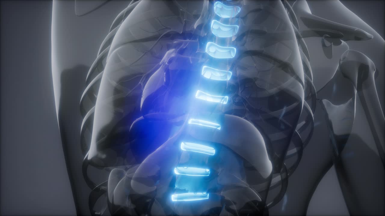 허리  ⁇ 에 허리 통증