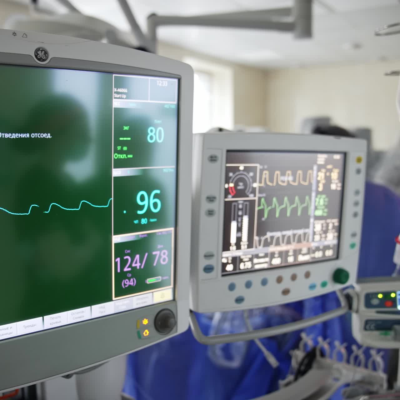 Monitor più grandi e più piccoli utilizzati in sala operatoria. Linee che indicano i segni vitali che scorrono sugli schermi. Primo piano