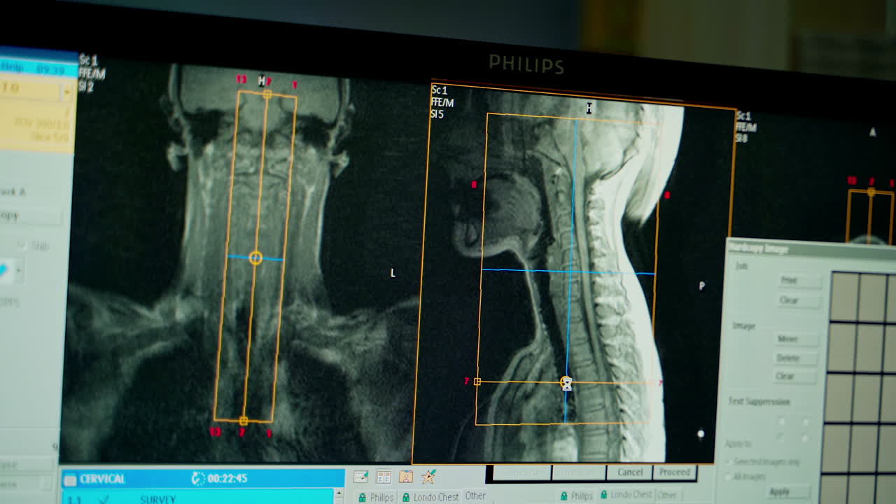 Close up of CT scan. Several CT computer tomography scan images
